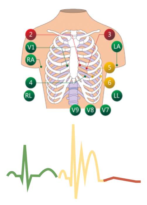 Compassus-3000-ECG-Portatil-Mapa-de-Conexao-de-ECG-e-Indicador-de-Sinal-alfamed
