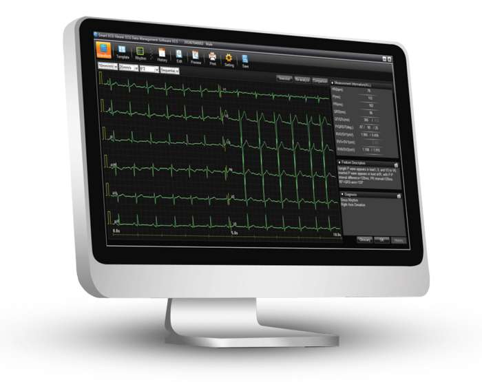 Compassus-3000-ECG-Portatil-Software-alfamed