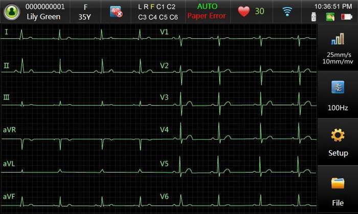 Software-de-ECG-alfamed